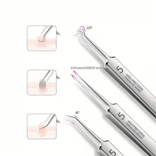 [BUY 2 AND GET AN EXTRA 10% OFF]💥Professional Facial Blackhead Remover Tweezers
